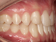 After - Ali Orthodontics Dental