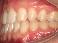 After - Ali Orthodontics Dental