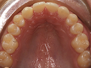 After - Ali Orthodontics Dental