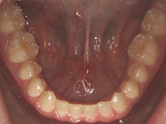 After - Ali Orthodontics Dental