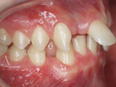 Before - Ali Orthodontics Dental