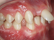 Before - Ali Orthodontics Dental