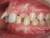 Before - Ali Orthodontics Dental