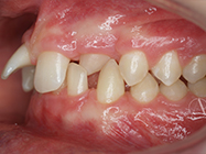 Before - Ali Orthodontics Dental