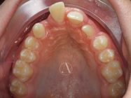 Before - Ali Orthodontics Dental