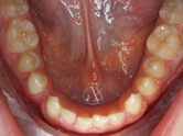 Before - Ali Orthodontics Dental