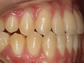 After - Ali Orthodontics Dental