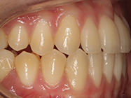 After - Ali Orthodontics Dental