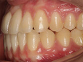 After - Ali Orthodontics Dental