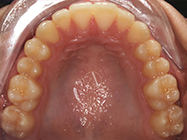 After - Ali Orthodontics Dental