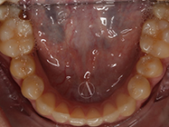 After - Ali Orthodontics Dental