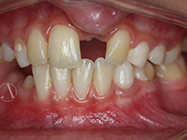 Before - Ali Orthodontics Dental