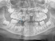 Before - Ali Orthodontics Dental