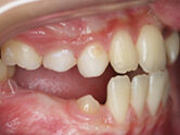 Before - Ali Orthodontics Dental