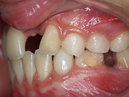 Before - Ali Orthodontics Dental