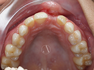 Before - Ali Orthodontics Dental