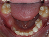 Before - Ali Orthodontics Dental