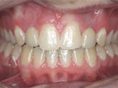After - Ali Orthodontics Dental