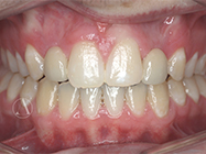 After - Ali Orthodontics Dental