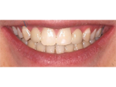 After - Ali Orthodontics Dental