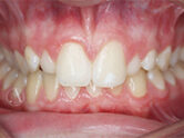 Before - Ali Orthodontics Dental