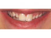 Before - Ali Orthodontics Dental