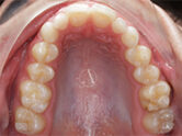 Before - Ali Orthodontics Dental