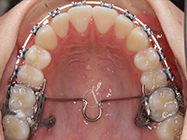 Progressive - Ali Orthodontics Dental