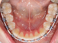 Progressive - Ali Orthodontics Dental