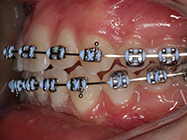 Progressive - Ali Orthodontics Dental