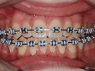 Progressive - Ali Orthodontics Dental