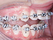 Progressive - Ali Orthodontics Dental