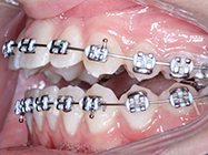 Progressive - Ali Orthodontics Dental