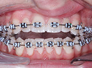 Progressive - Ali Orthodontics Dental