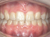 After - Ali Orthodontics Dental