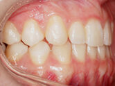 After - Ali Orthodontics Dental