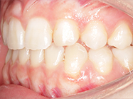 After - Ali Orthodontics Dental