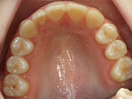 After - Ali Orthodontics Dental