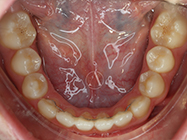 After - Ali Orthodontics Dental