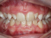 Before - Ali Orthodontics Dental