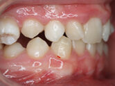 Before - Ali Orthodontics Dental