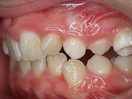Before - Ali Orthodontics Dental