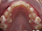 Before - Ali Orthodontics Dental