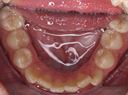 Before - Ali Orthodontics Dental