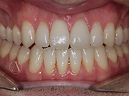 Progressive - Ali Orthodontics Dental