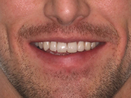 Progressive - Ali Orthodontics Dental