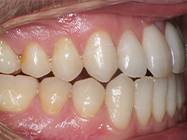 Progressive - Ali Orthodontics Dental