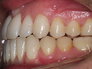 Progressive - Ali Orthodontics Dental