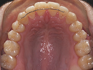 Progressive - Ali Orthodontics Dental