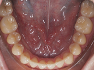 Progressive - Ali Orthodontics Dental